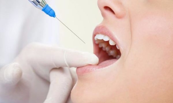 Лечение зубов анестезия